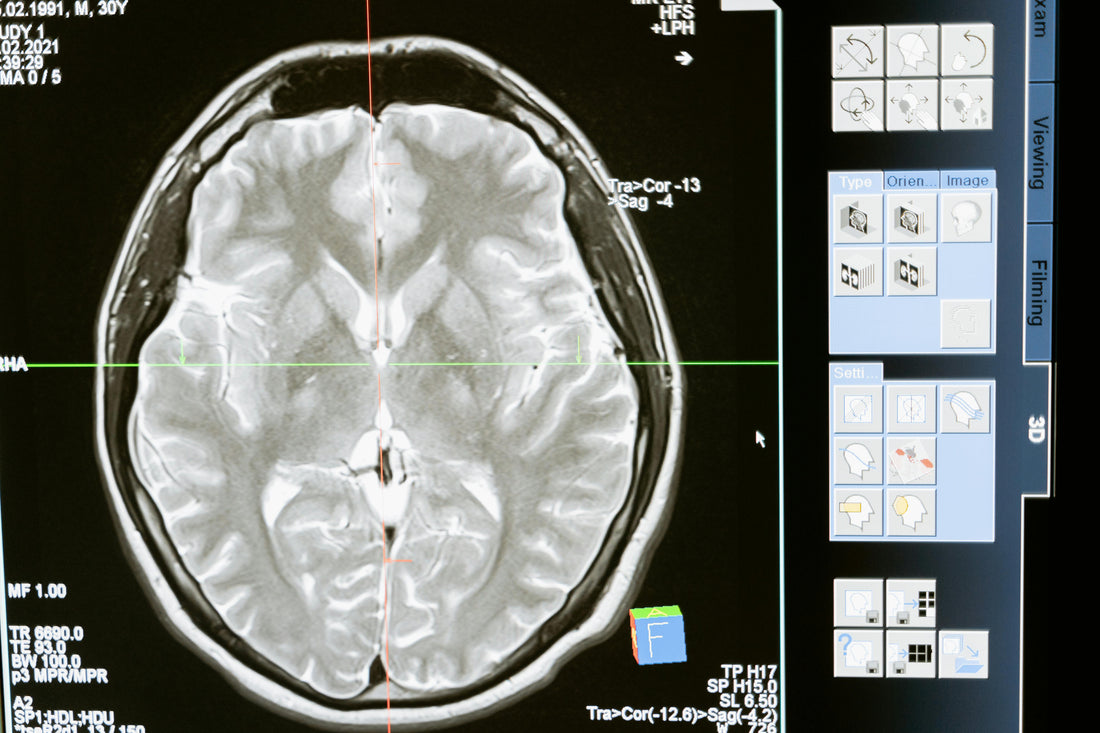 Better Fitness, Healthier Brain: What Science Says About Aging