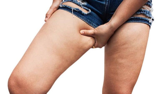 Why Leg Fat Might Matter More Than You Think