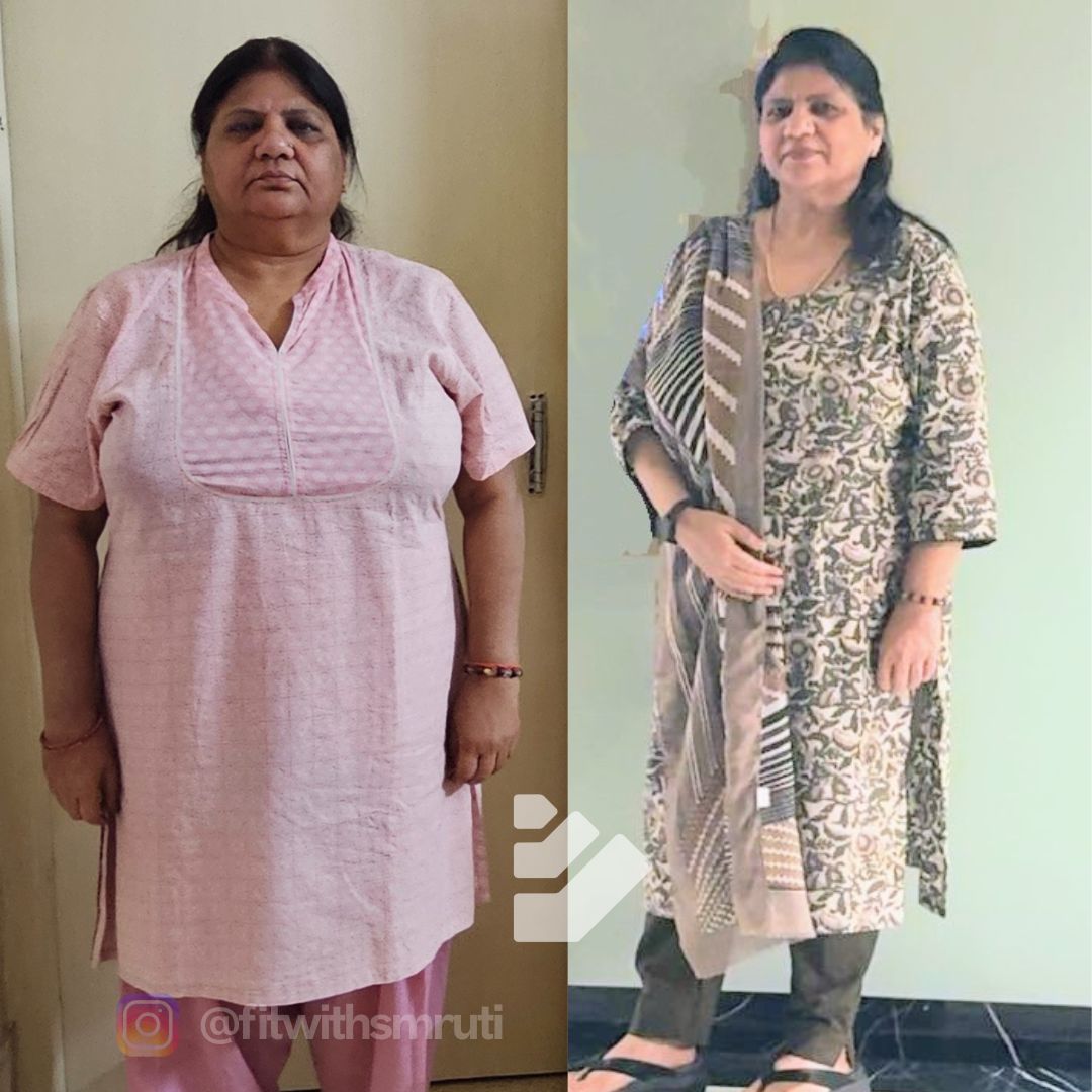 Transformation Image