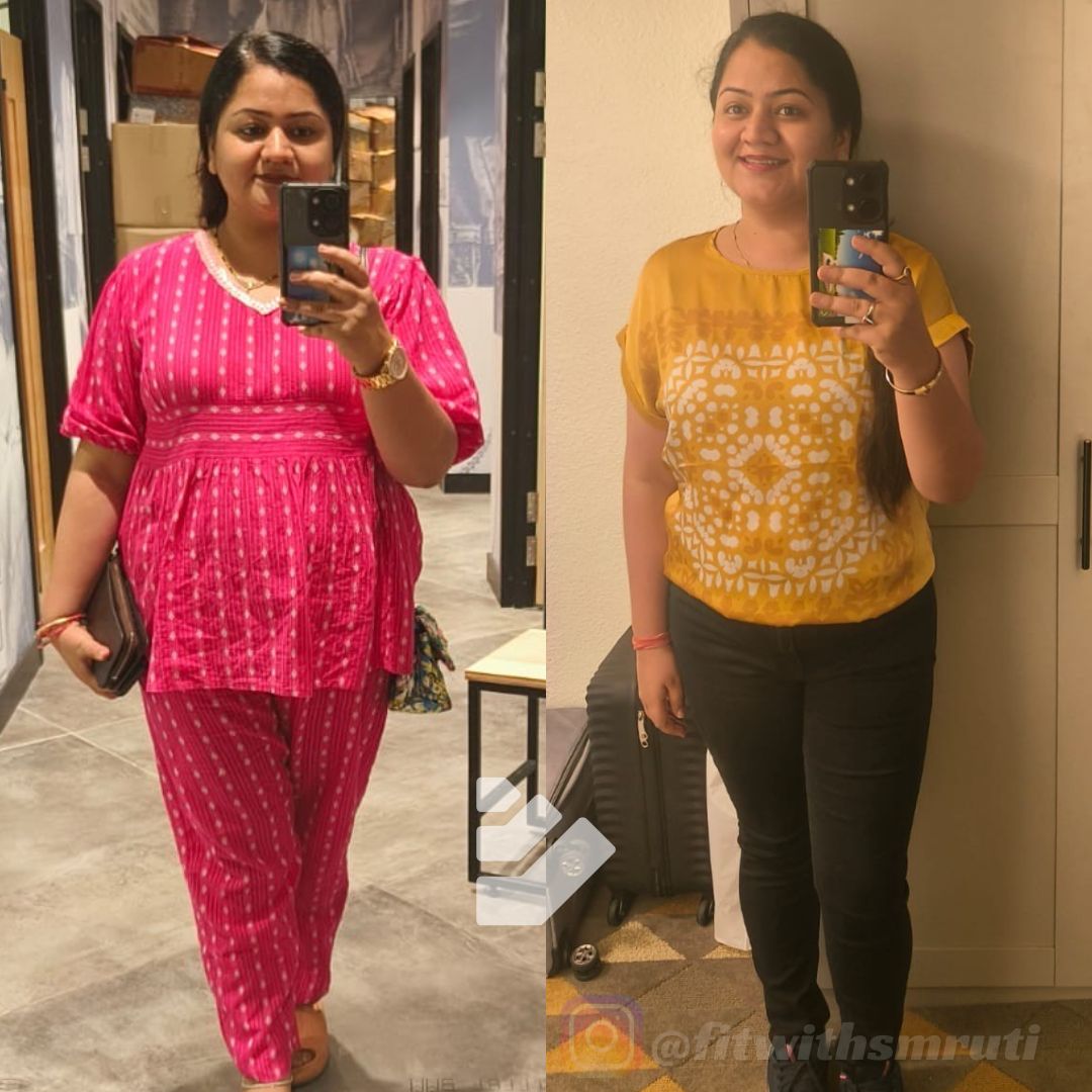 Transformation Image