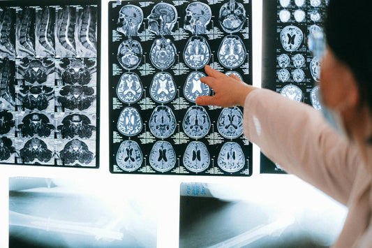 Does the Brain Need More Creatine Than Muscles?