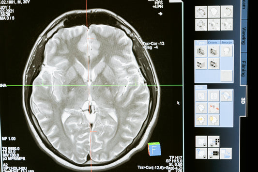 How Too Much Sitting May Affect Your Brain Health