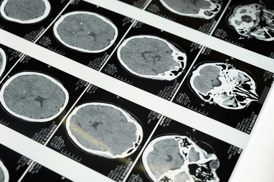 How Brain Scans Are Changing What We Know About Pain