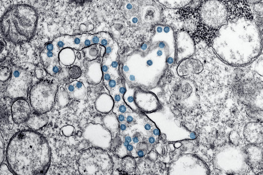 How Low LDL Cholesterol Affects Your Risk of Infections