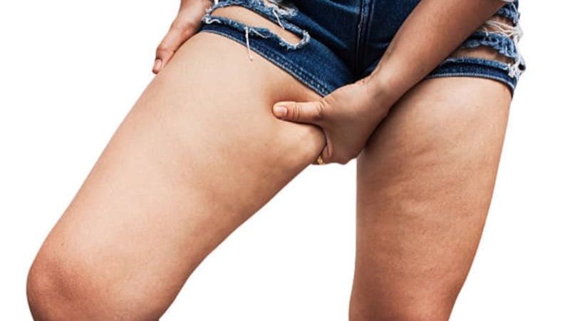 Why Leg Fat Might Matter More Than You Think