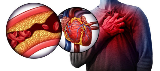 How to Lower LDL-C and Triglycerides Naturally: An Indian Guide