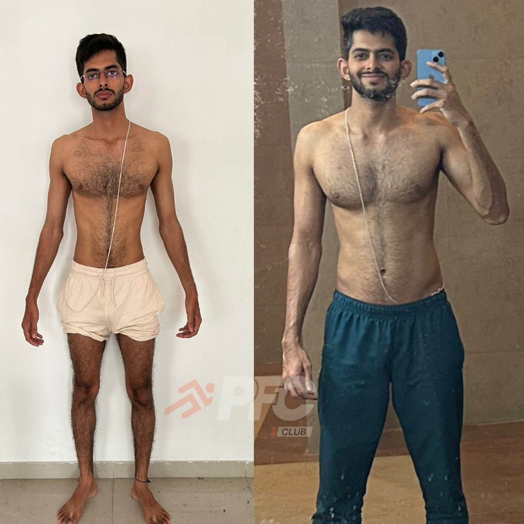 Transformation Image